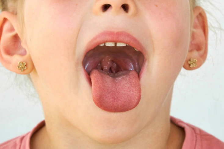 Airway Dentistry in Shady Spring and Lochgelly, WV