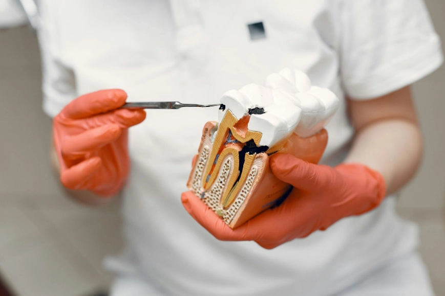 Endodontic therapy in Shady Spring and Lochgelly, serving surrounding areas such as Beckley, Princeton, Lewisburg, Oak Hill, Summersville, Fayetteville, and Hinton.